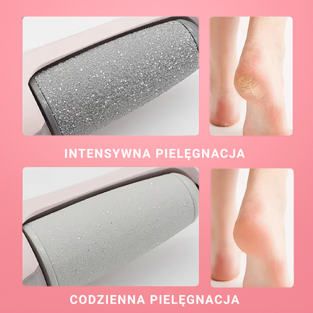 skinee elektryczny pilnik do pięt